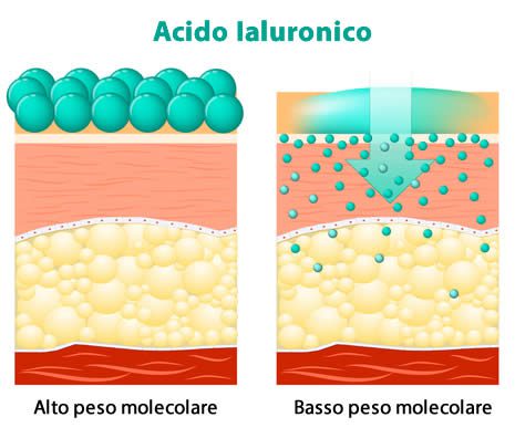 acido ialuronico